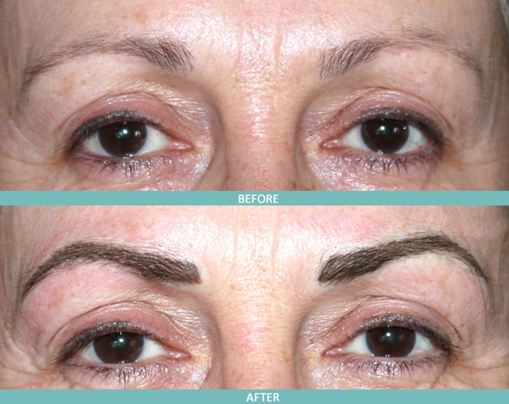 Eyebrow Tattoo Before After And Healed Photos Youtube 